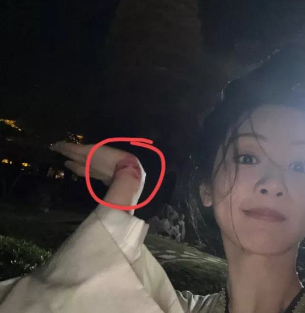 杨紫啊杨紫，你可真是给我吓坏了，猛的一看，你手腕上怎么全是血，点进去一看