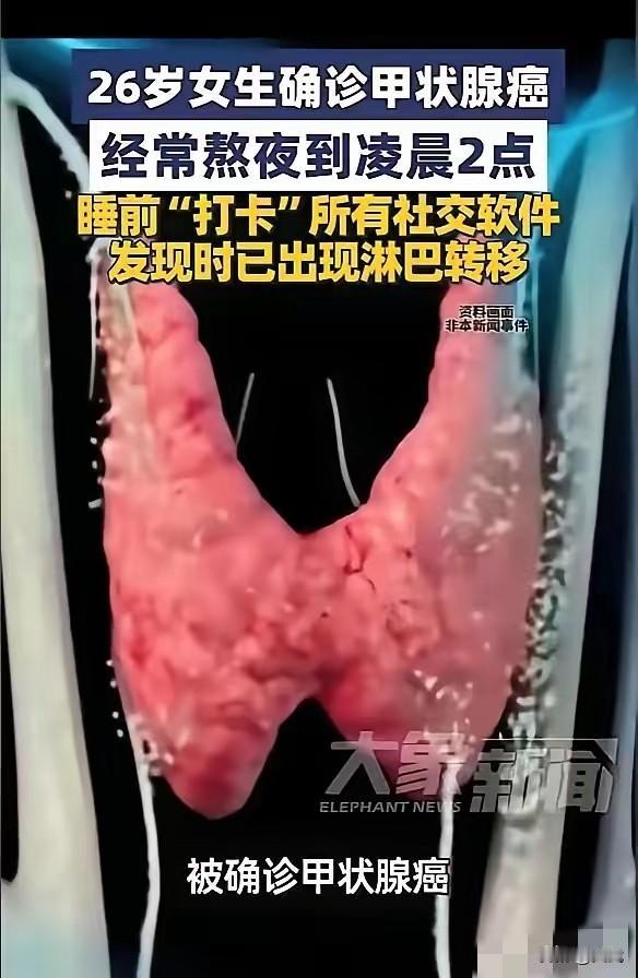 刷手机到凌晨2点，年轻女子确诊甲状腺癌！网友：不敢熬夜了，26岁的年轻女子，每天
