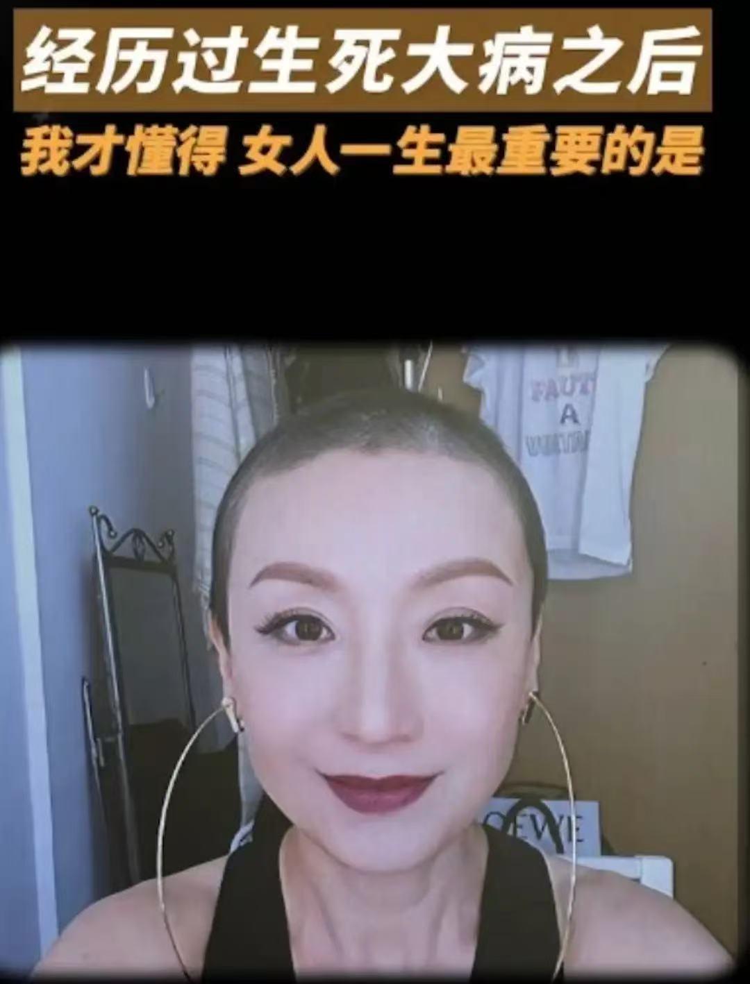 62岁港姐周美凤公开患癌细节，自曝一针标靶药高达20万！第一次见光头也这么美的
