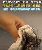 防不胜防！广西桂林，一女子早上醒来感觉脸上脖子上刺挠得厉害，像刚理完发沾了一身碎