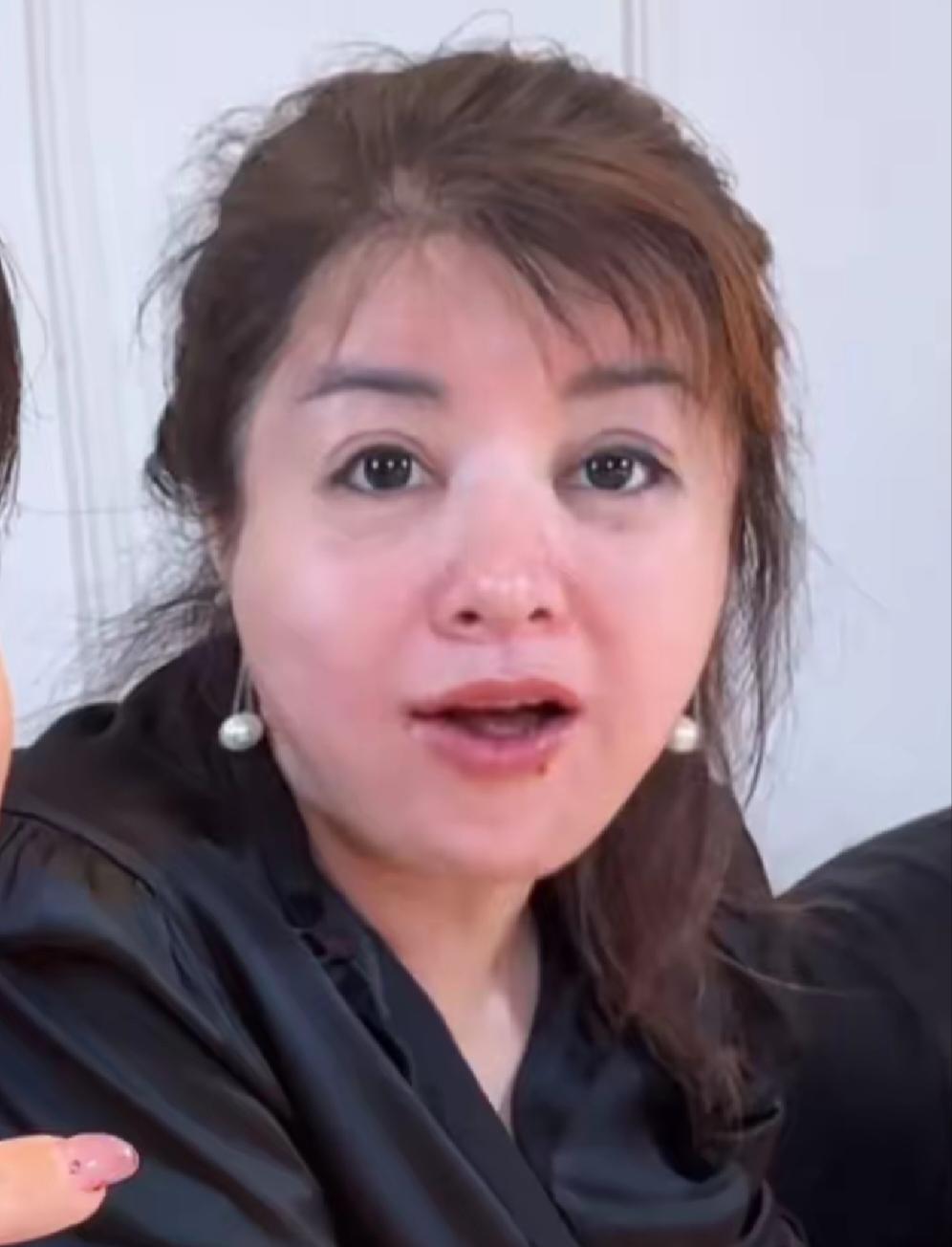 那些医美的天塌了于文红的高清无美颜照片一出，不知道有多少人的梦醒了，于文红花了
