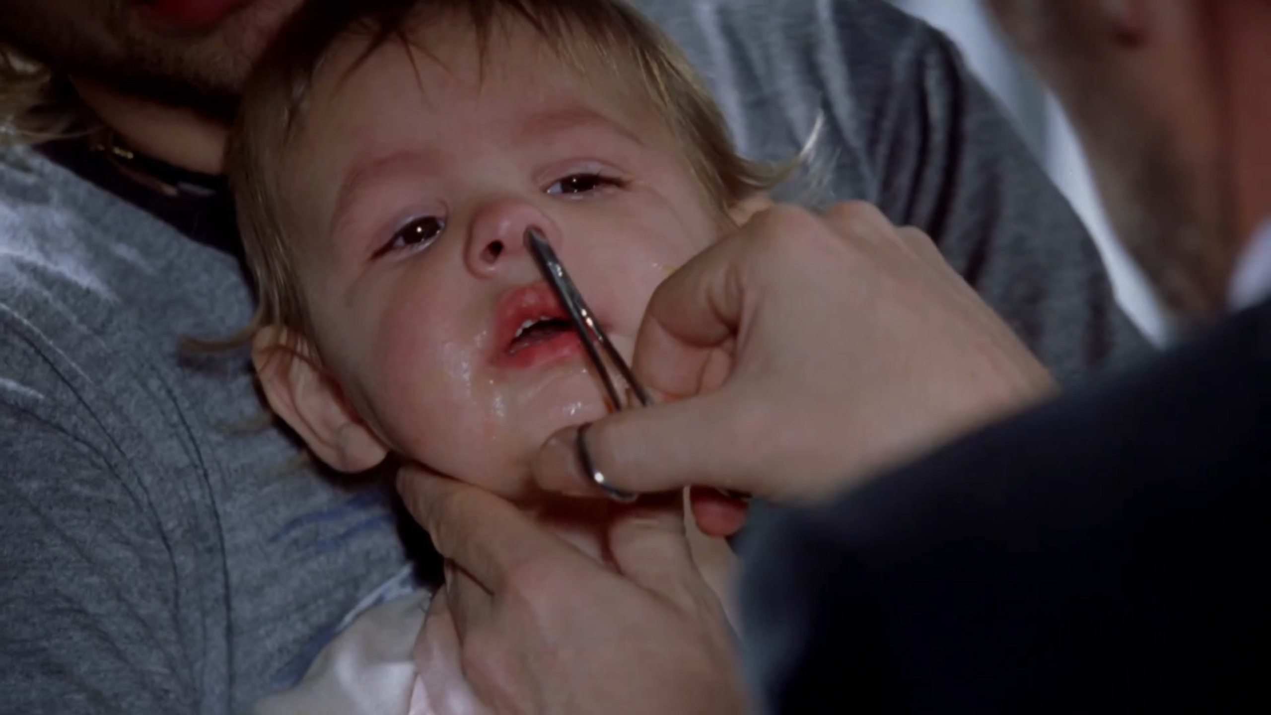 惊险一刻！医生从男孩鼻孔夹出玩具