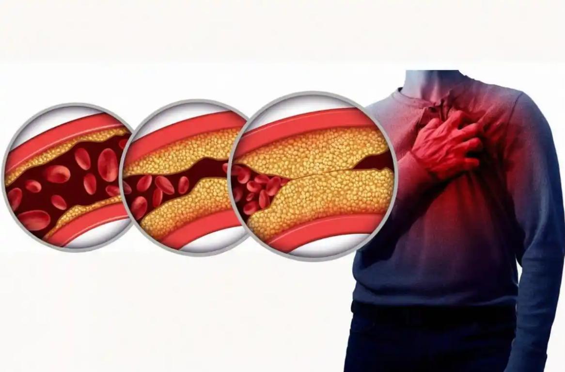 冬至后的八十一天，注意心脑血管保养，这个中成药，温血通脉，让血管越来越顺畅从