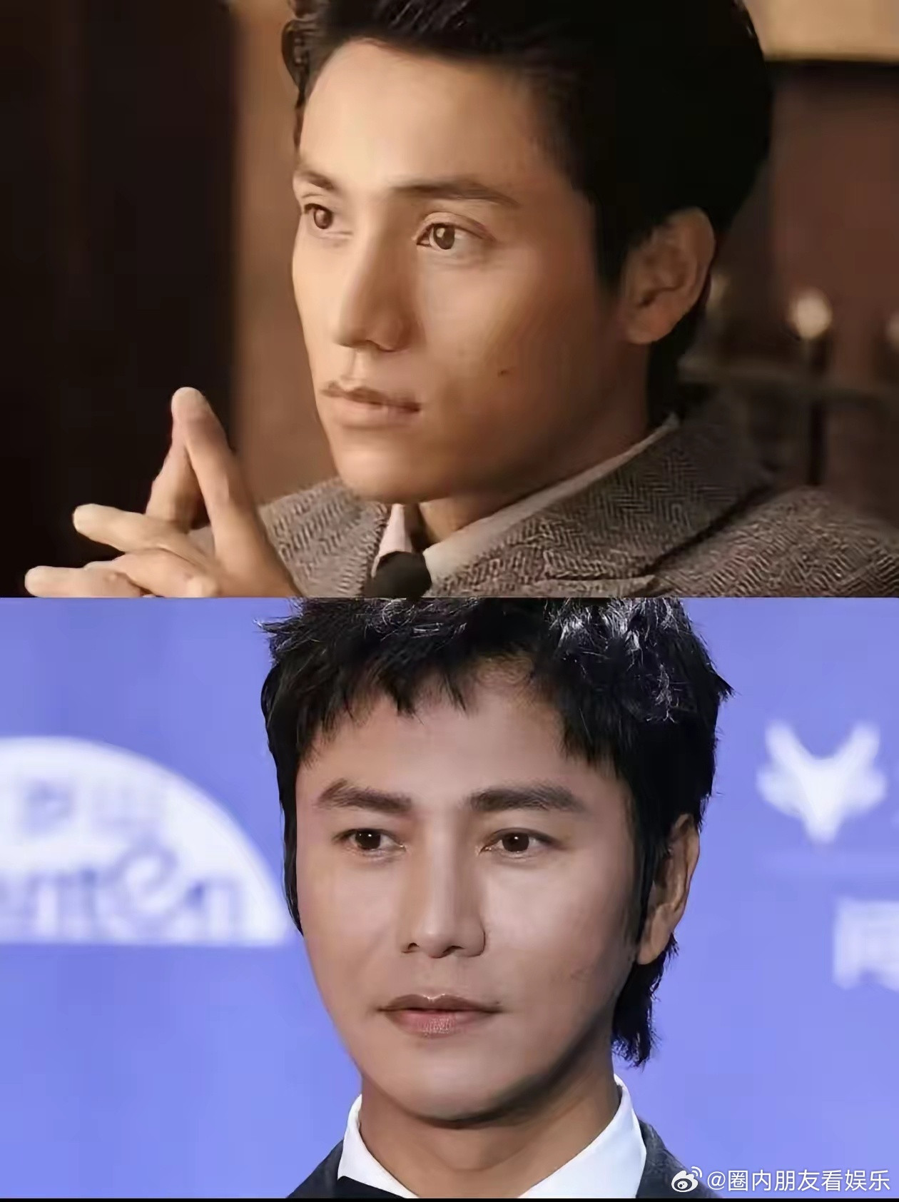 女明星艺人前赴后继do脸、做医美我忍了，可男明星也跟风捯饬脸，真让人无法接受。看