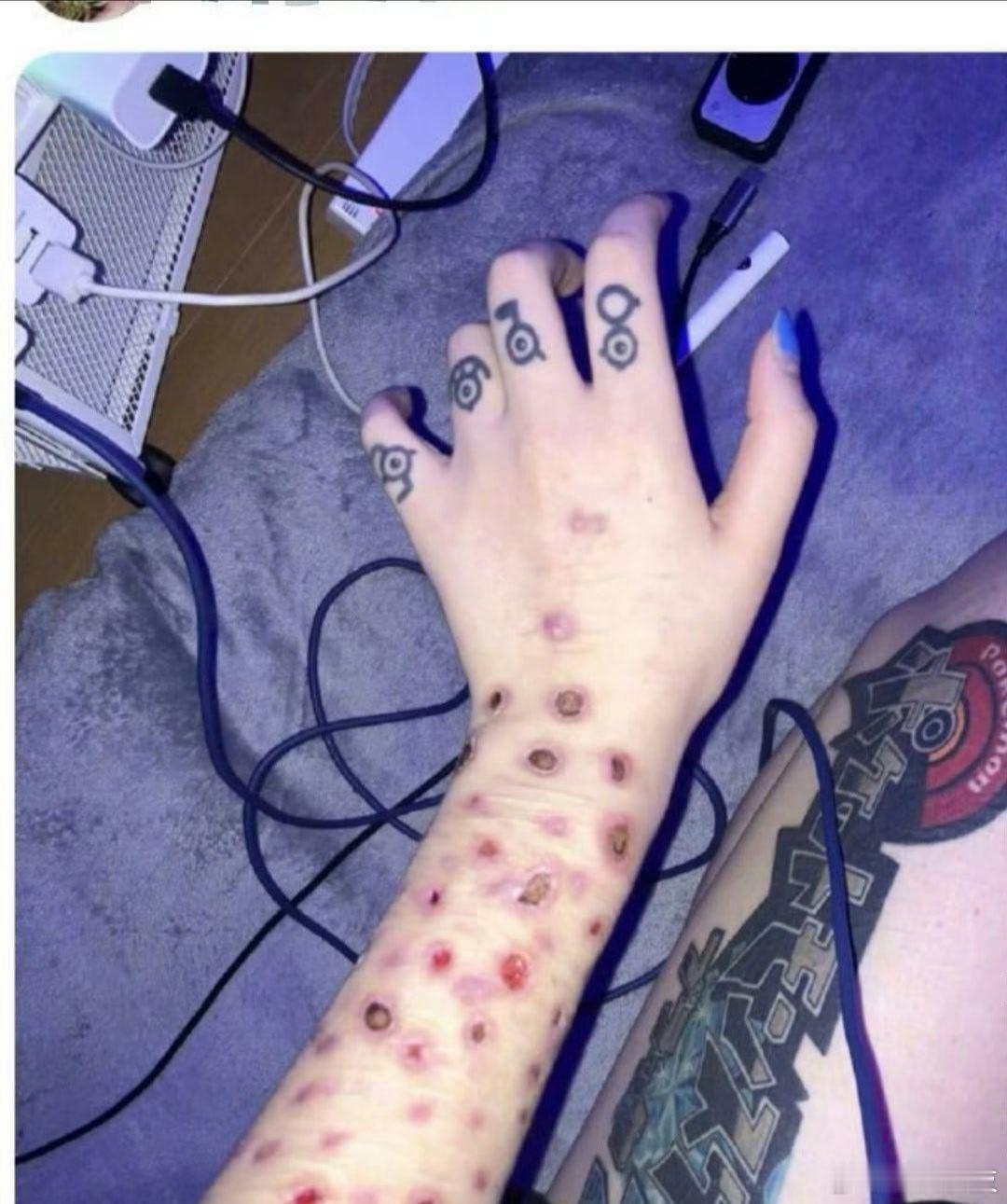 日本年轻人聚众晒梅毒不是吧？今天还在跟家人聊寒假要不要先去日本玩一周再回家过年？