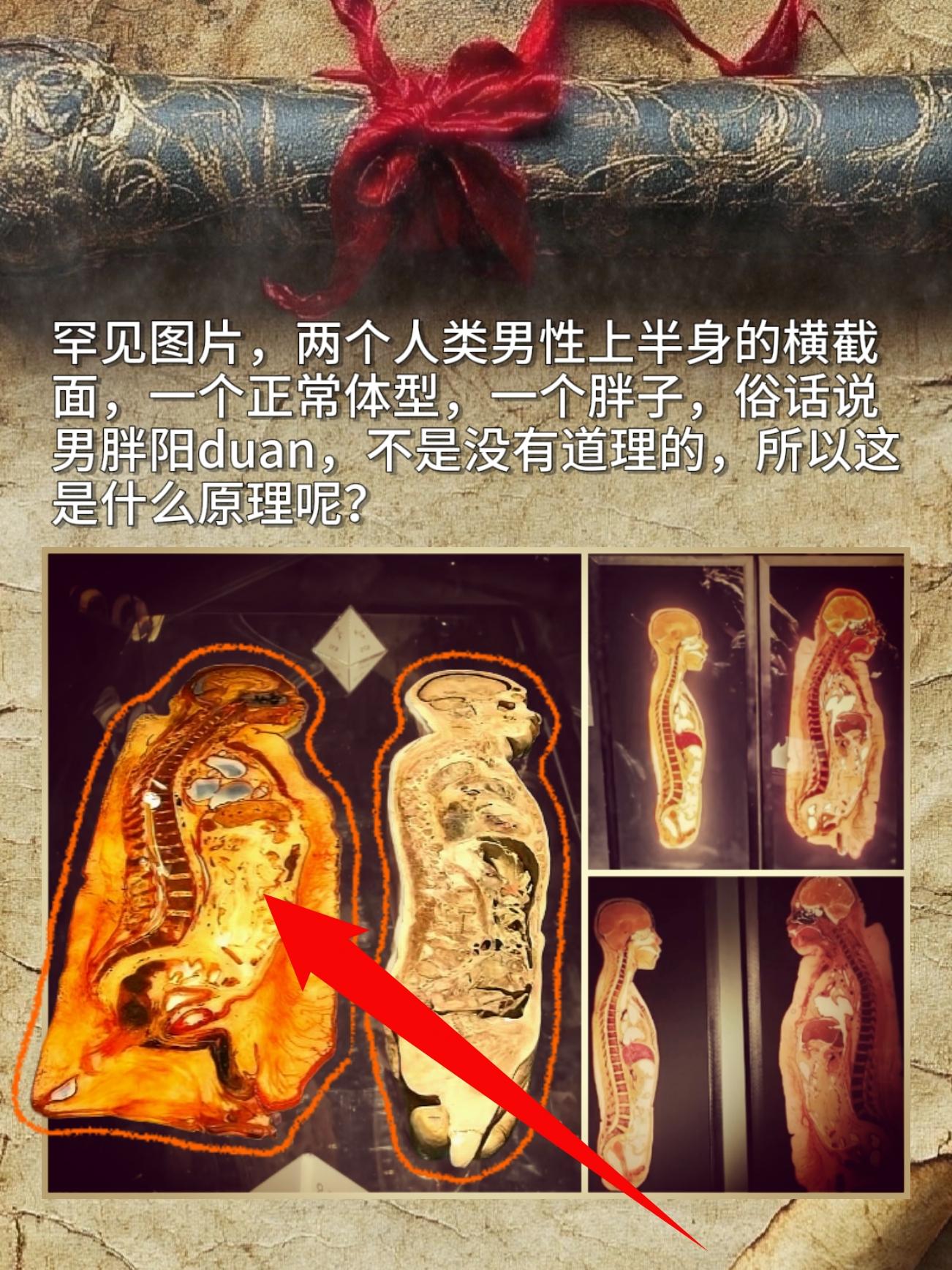 罕见图片。两个人类男性上半身的横截面，一个正常体型，一个胖子。