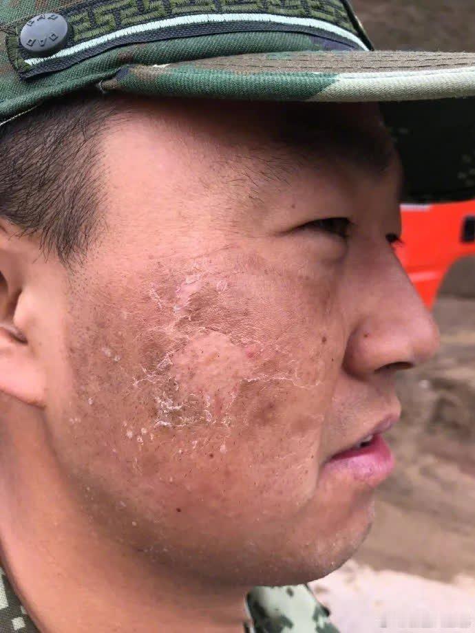 致敬中国军人！【这才是中国“最帅”面孔】西藏军人的美，是美在脸上的高原红，是美在手上的皴裂老茧，那是