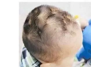 据说孩子头上旋越多, 证明他的智商就越高, 是真的吗? 网友: 我娃才三个