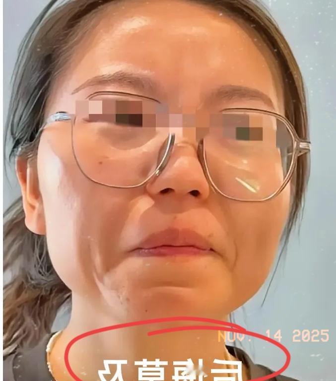 山西狗咬人事件的后续反转，哪是纠纷升级，分明是两份迟来的悔恨，砸醒了所有人！