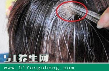 年纪轻轻就白发了, 鸡蛋加点它煮着吃, 不到一个月黑发全冒出来了, 非常见效