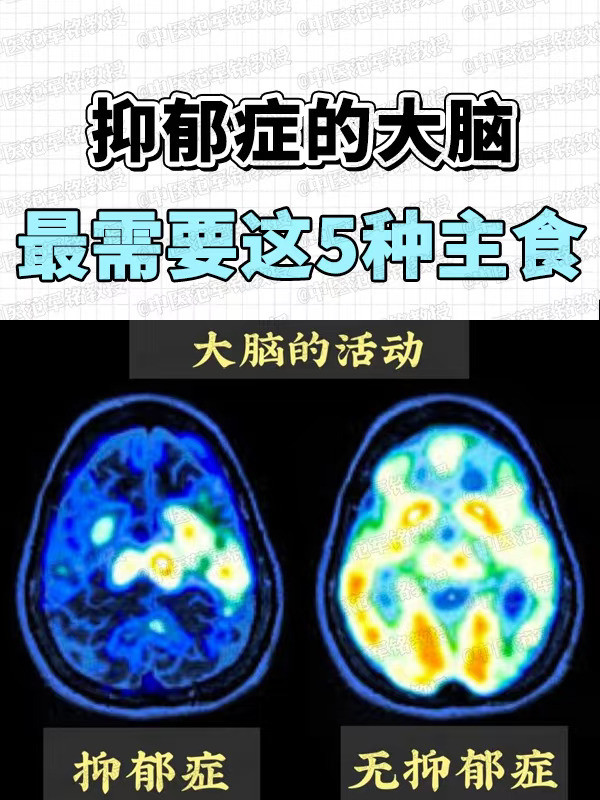 抑郁症的大脑，最需要这5 种主食 . 近期全新研究成果显示，肠道，作为...