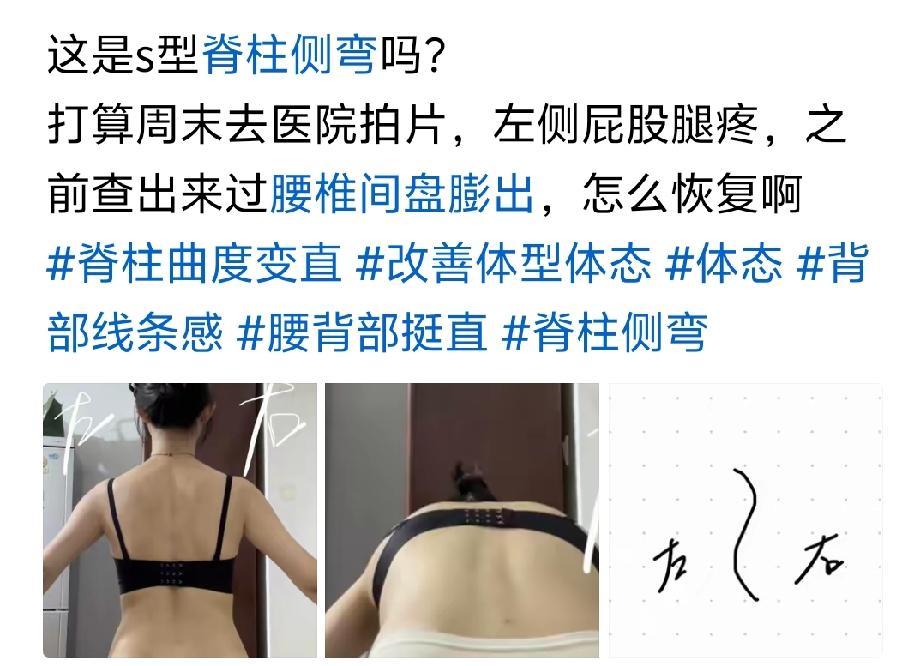 弯就弯呗，我尿尿也往右偏