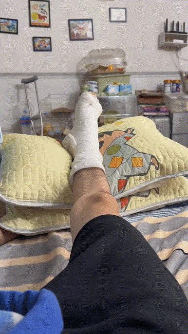 主人腿骨折，宠物鼠开启模仿秀……