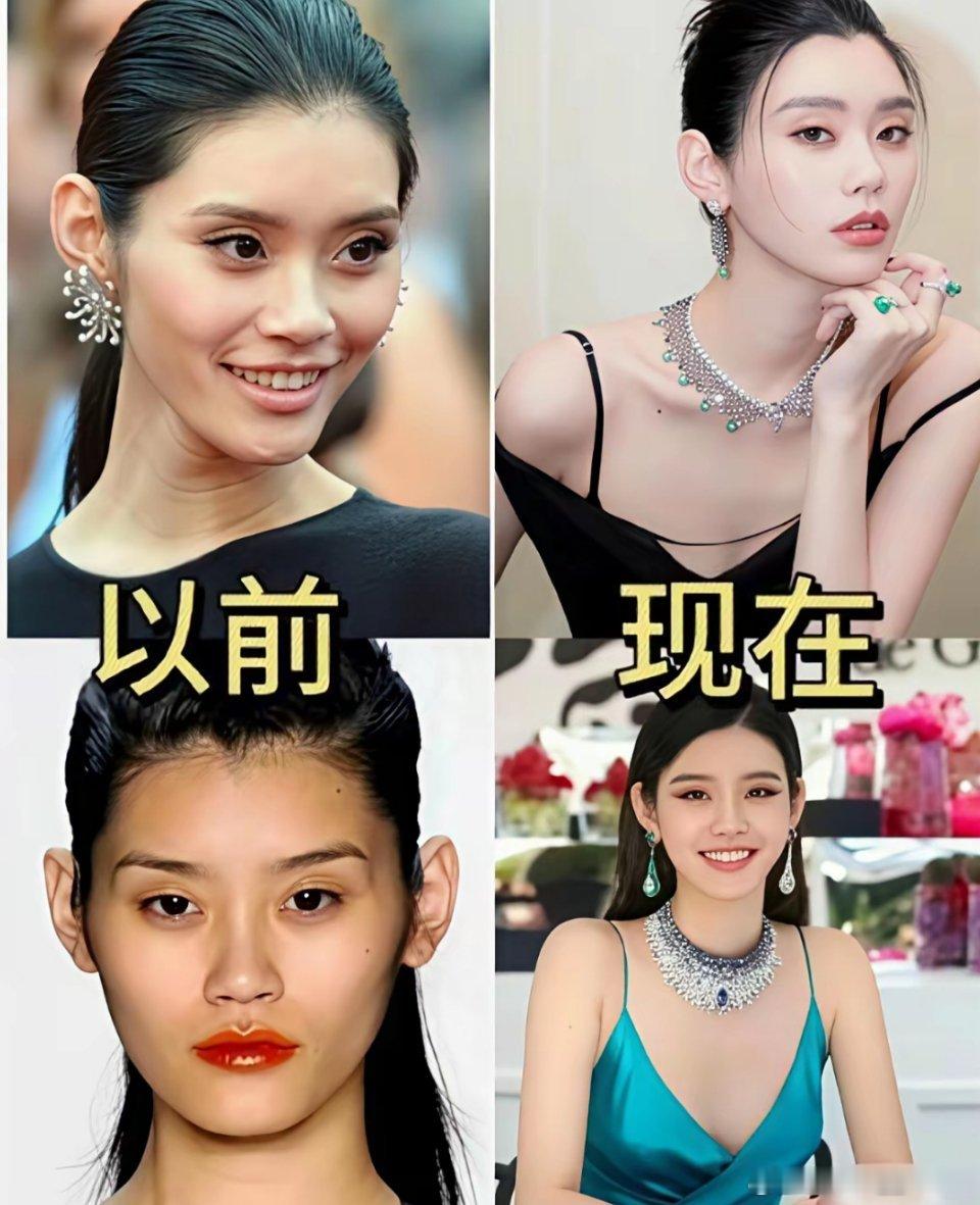 奚梦瑶感觉全脸都医美了吧！以前颧骨特别高，脸很凹现在和以前完全判若两人何猷君这是