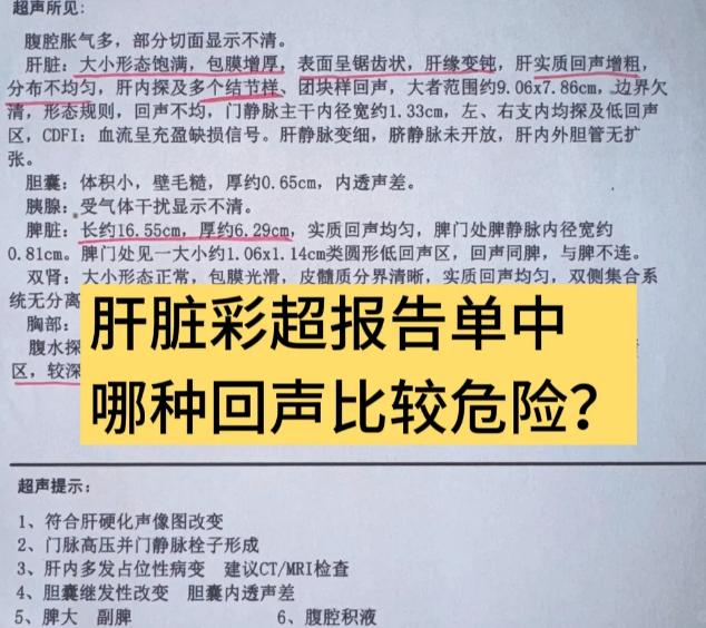 肝脏彩超5种回声哪个更危险！低回声结节，可能是肝癌，需及时增强CT/MRI确诊