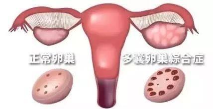 想怀孕, 吃避孕药? 试管婴儿, 却宫外孕? 医生, 我需要一个解释!