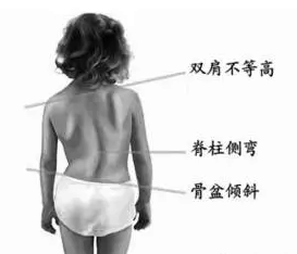 “驼背小老人”频现? 是什么让6-12岁的孩子“未老先衰”