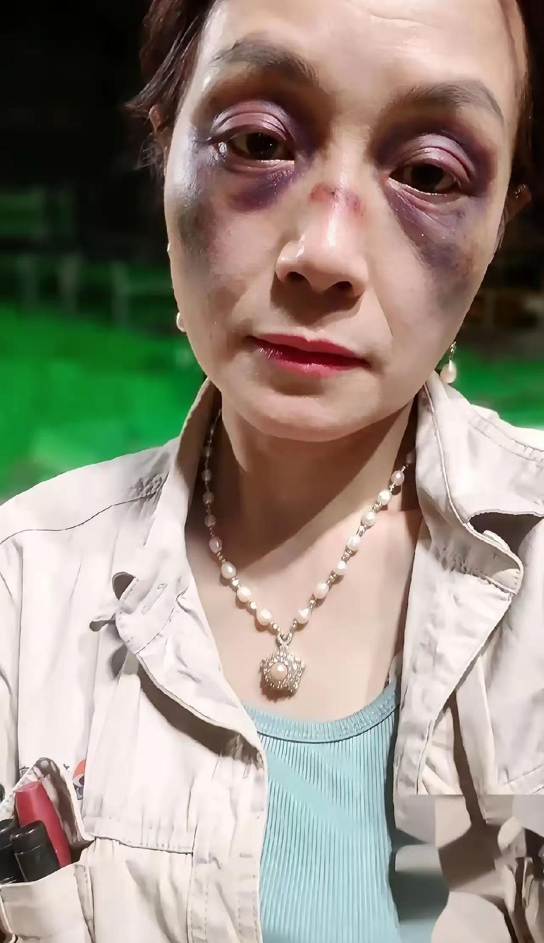 昨晚大排档那档子事，想必不少人都刷到过吧？​36岁的离异女同事，和男同事加完