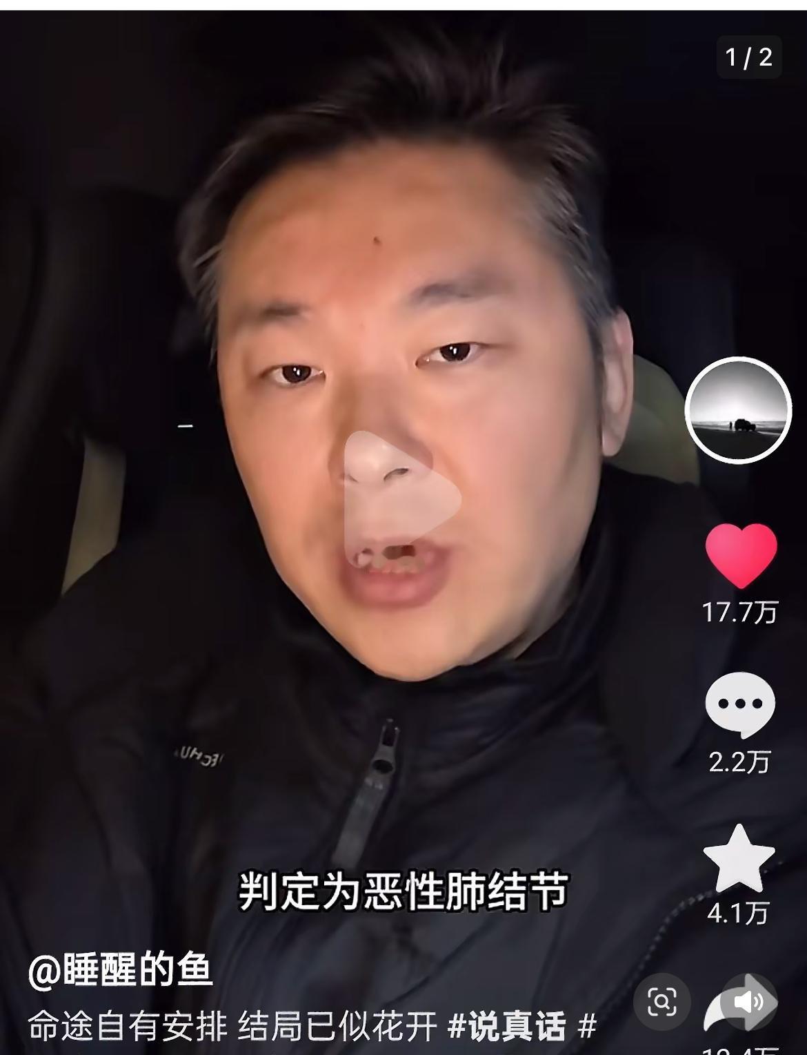 一名42岁东莞男子，被4家三甲医院确诊肺癌，却在做手术前发现误诊。网名叫睡醒的鱼