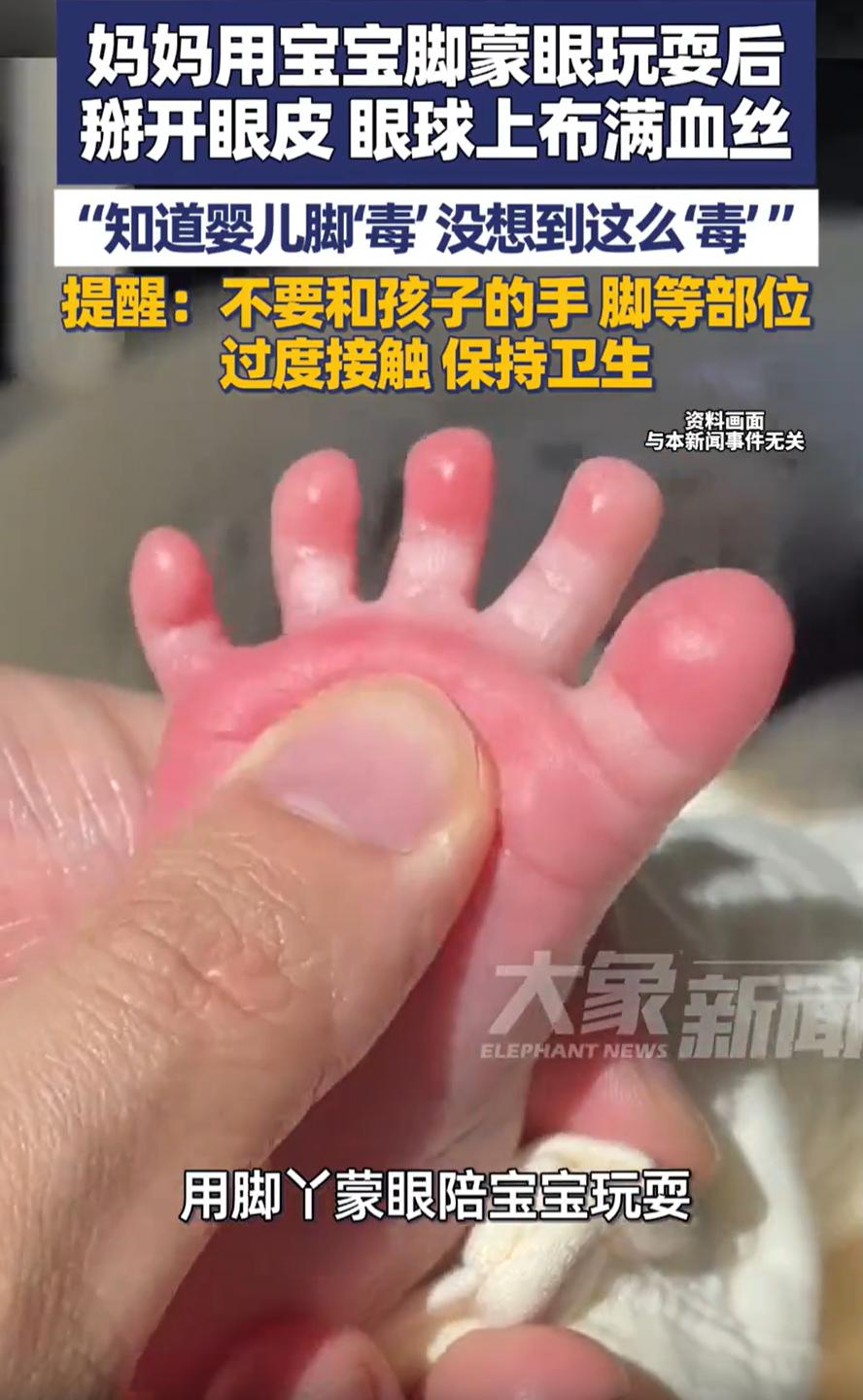 担心的事情还是发生了！江苏，一位宝妈在家和宝宝互动，拿孩子的小脚丫蒙住自己的眼睛