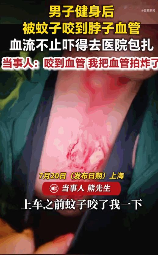 这也太可怕了！上海街头，一名浑身肌肉线条的年轻小伙刚迈出健身房，只因为被蚊子叮了