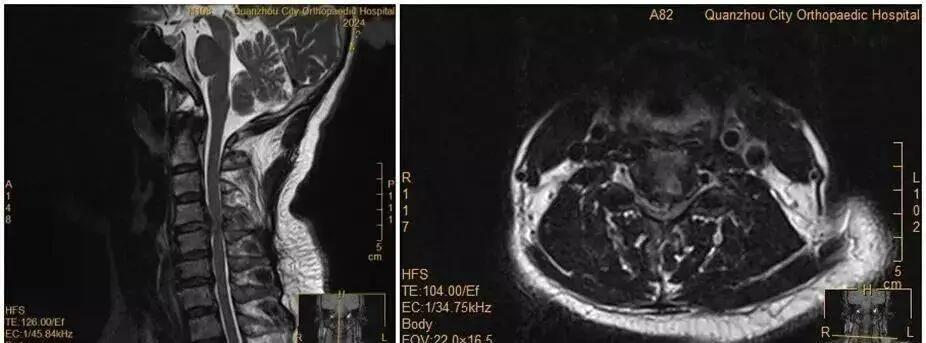 女子夜里翻身拿手机，突然瘫痪！医生怒斥：这些“致命习惯”，90%的人每天都在犯