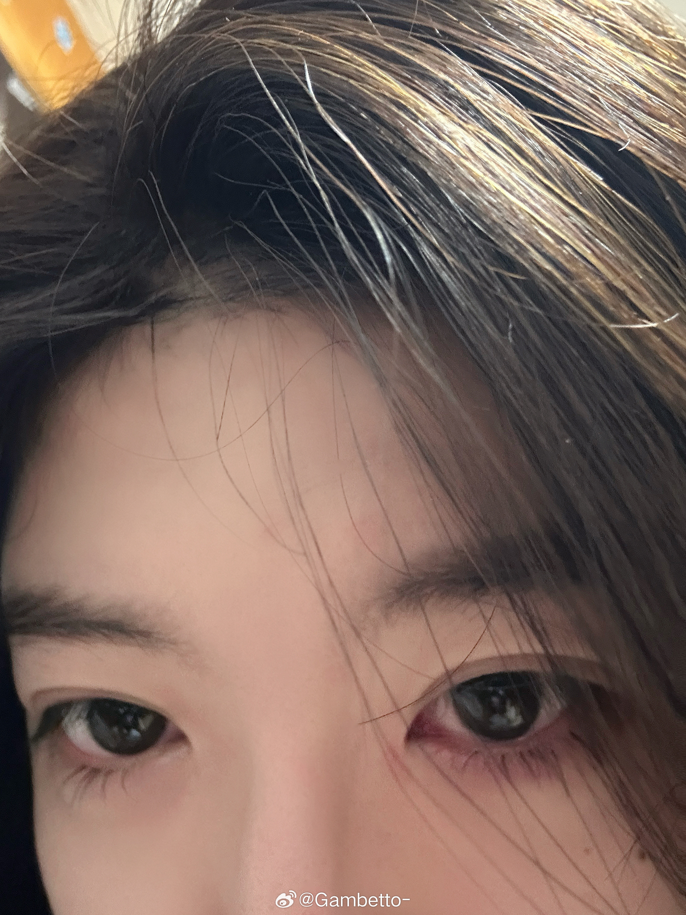 鼻炎眼睛痒的要s了….有没有什么药可以缓解一下啊每天早上醒来就是打喷嚏流鼻涕流眼