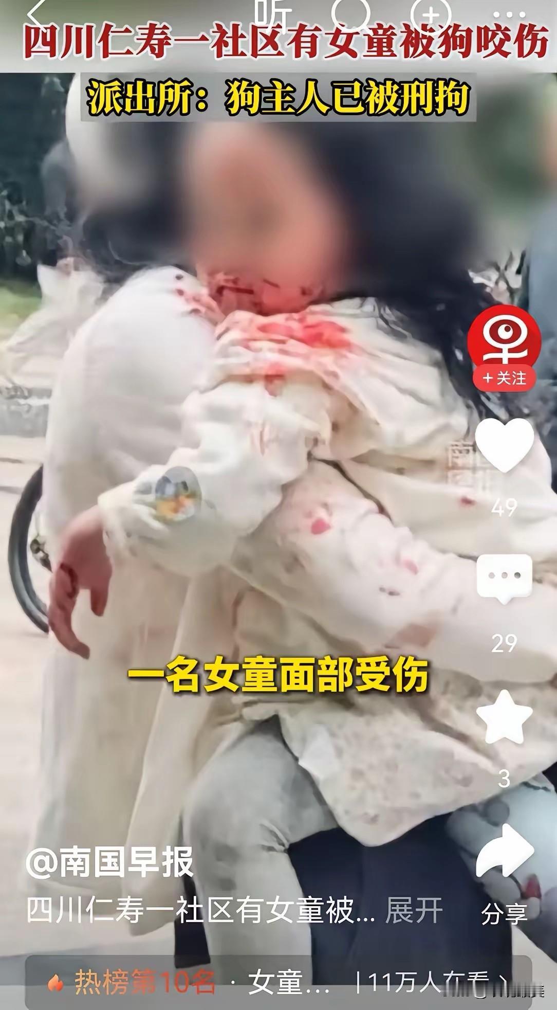 “狗患不除永无宁日”，看到这个画面，实在是让人痛心！可怜的小女孩，面部伤成这