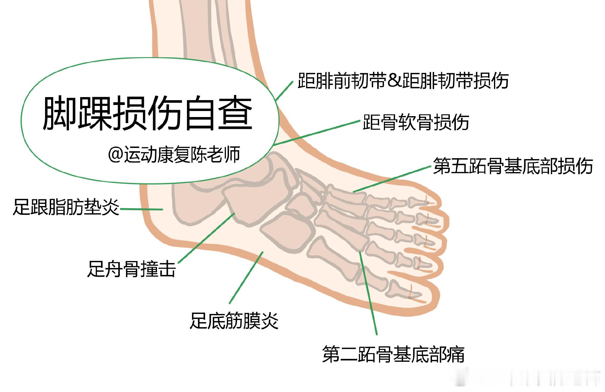 脚踝疼痛自测脚踝疼痛不适，只能来线下处理。大家想到脚踝，可能只是一个“踝”，但