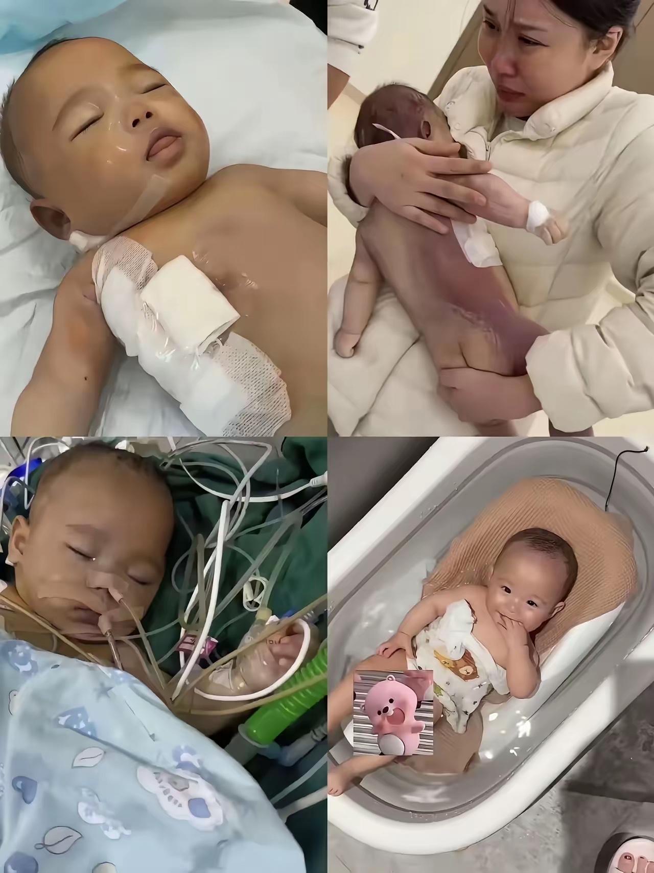 5个月宝宝手术9小时离世，吐舌寻奶的模样，看完真的破防了！谁能想到，医生口中