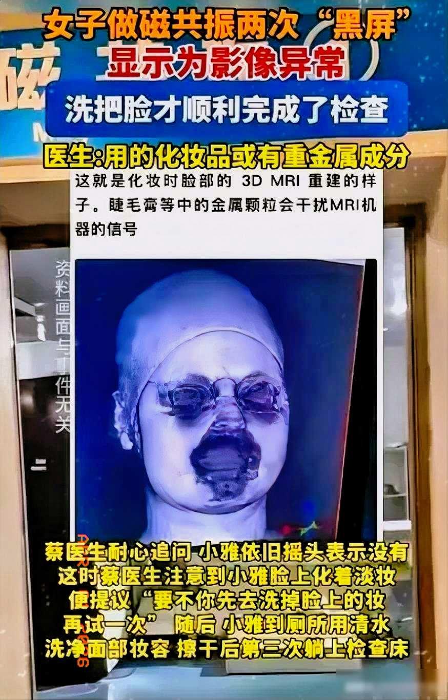 解释不清了！福建一家医院最近发生一件怪事，一个二十九岁的女人因为头晕去检查，做头