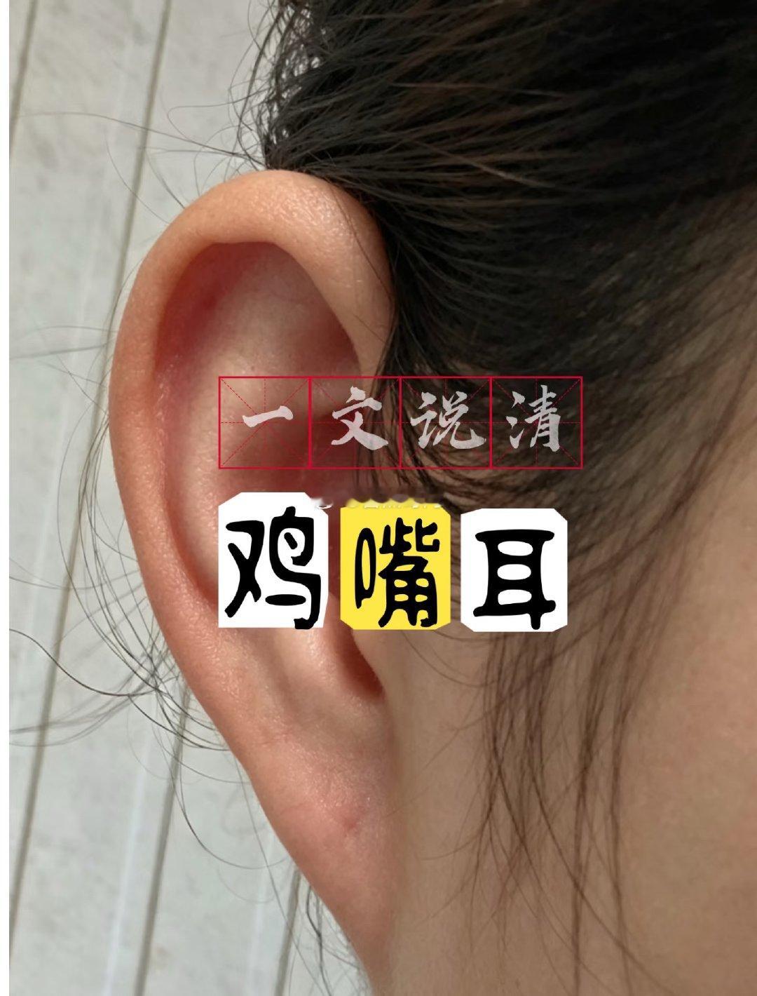 有些面相是真的可以独断的，现实中见过好几个鸡嘴耳，说白了就是没有耳垂的那种！特别