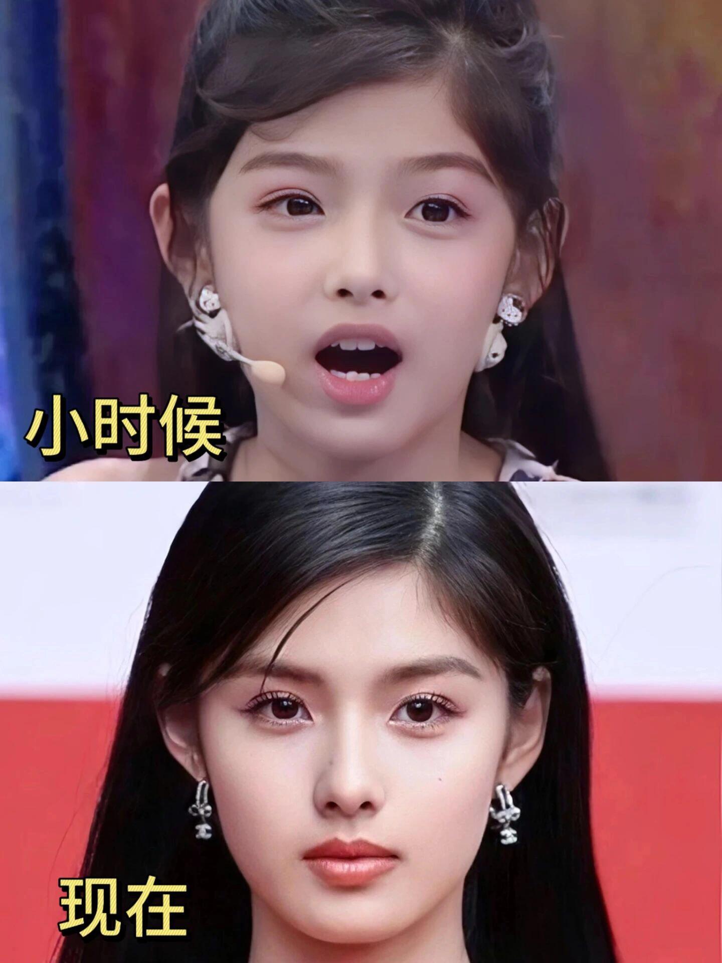 艾米居然才17岁？褪去婴儿肥的艾米骨相的优越瞬间凸显，真是少见的长大后比小时候还