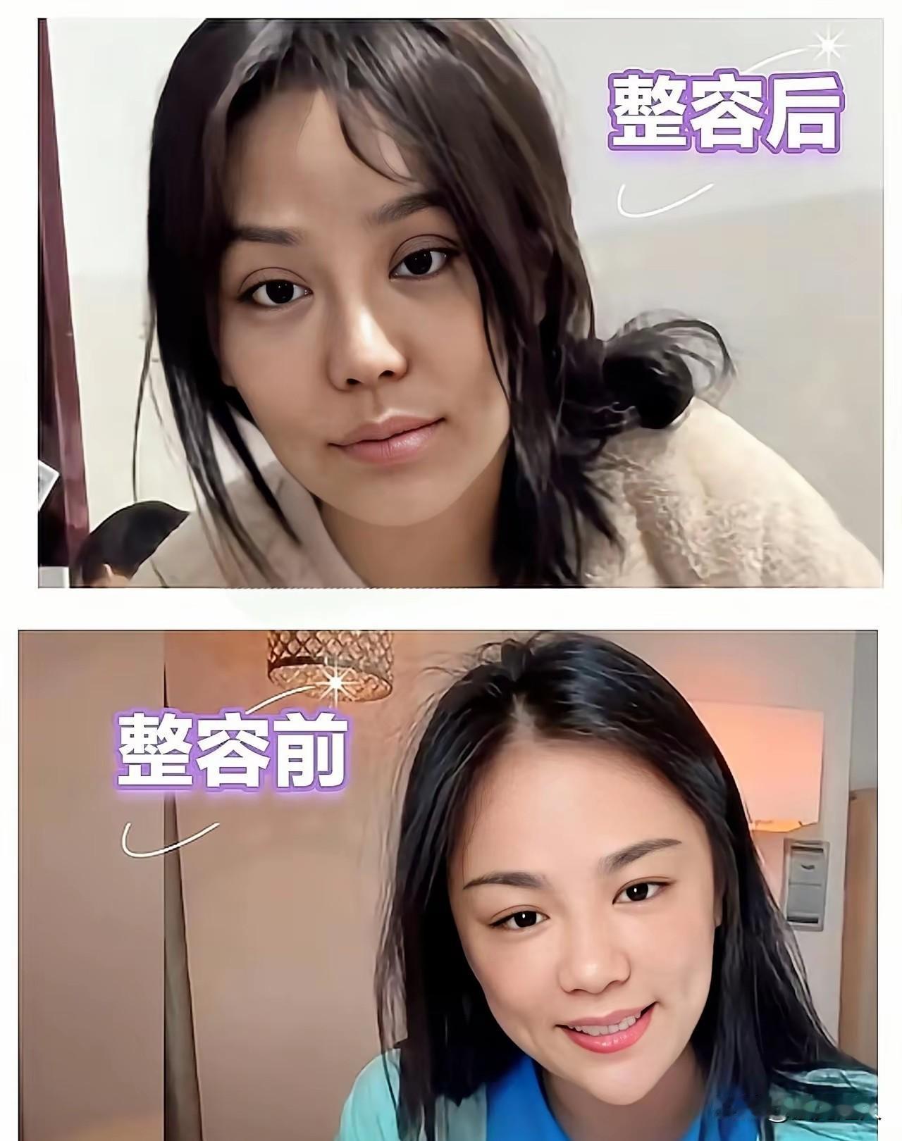 千万网红樊小慧，最近在直播里说了一件事，听着挺让人唏嘘的，她已经把当初植入的肋软