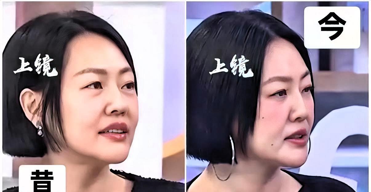 小S为了遮痘痘点成假痣，全网都在研究它旺不旺夫？这才是内娱最荒诞的一幕两颗用