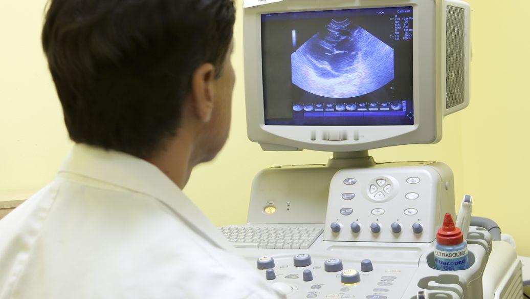 我国有上千万人做心脏彩超！医生直言：做一次彩超，或管七年无碍 每年都揪着心查