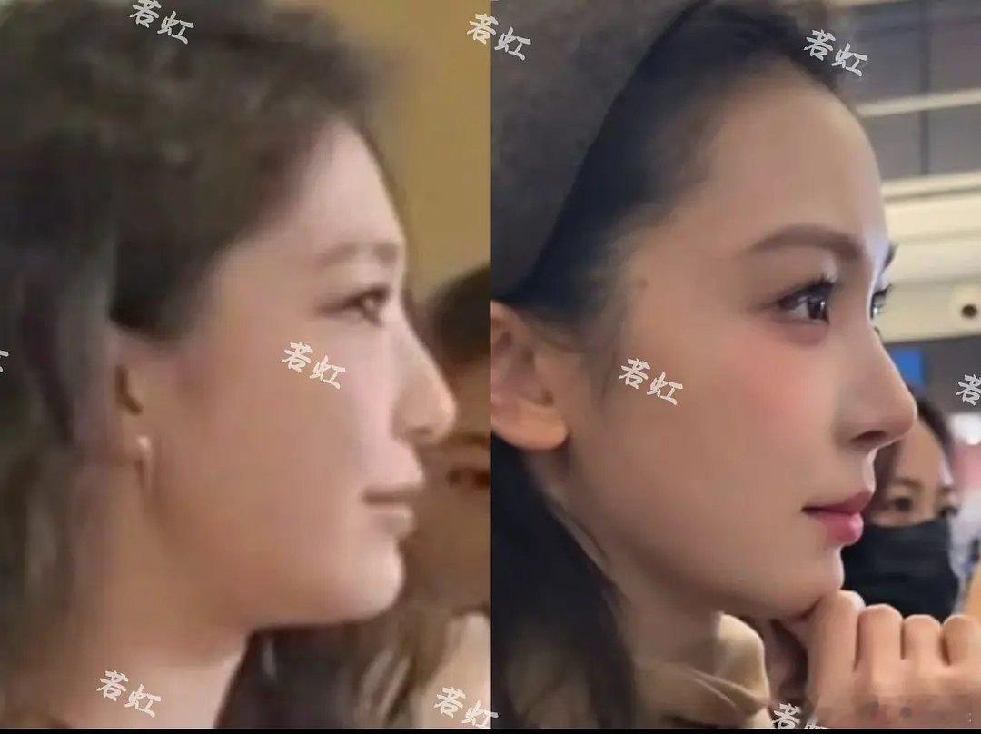 易梦玲怎么整成赵樱子了