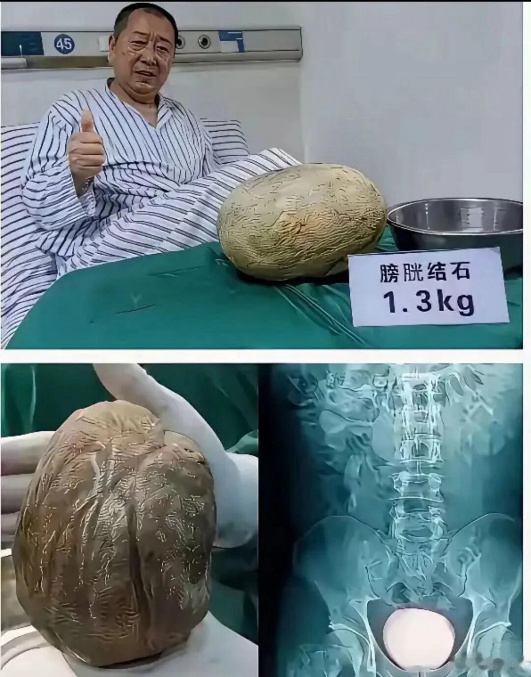 我去？鲸到了，不是很懂但大为震撼搞笑