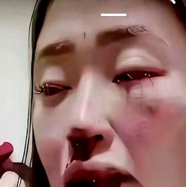 178万的现金，装在袋子里，人肉背到印度。结婚仅仅7个月，钱被榨得一干二净。