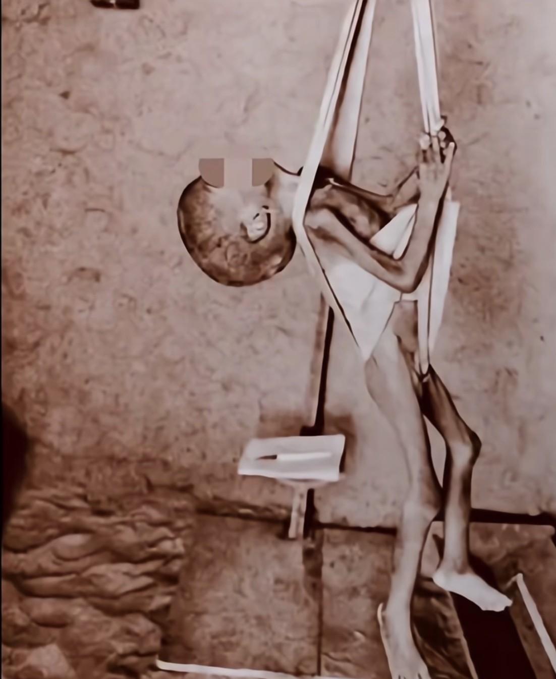 网上有张1944年的照片，小孩瘦得像根竹竿挂在竹竿上。有人说可能是家里怕野兽叼走