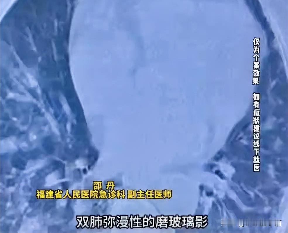 惊有“羽绒肺”一件廉价羽绒服，竟成了压垮肺部的“元凶”，这则新闻撕开了生活