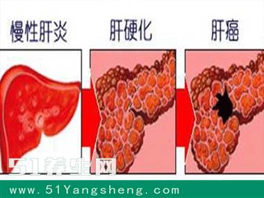 肝癌最怕这4种零食, 医生说天天来一口, 轻松疏泄肝气、排除肝毒
