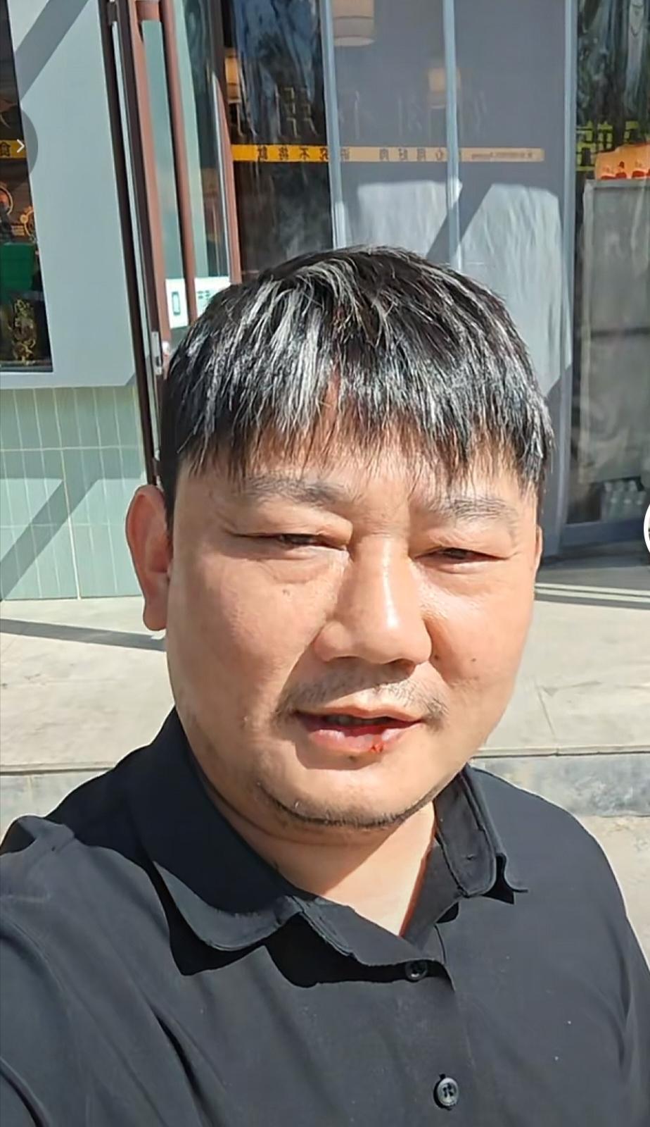 张雪终于把他那头长头发给剪了，剪了新发型的张雪看起来年轻了好多岁，也干净了很多。