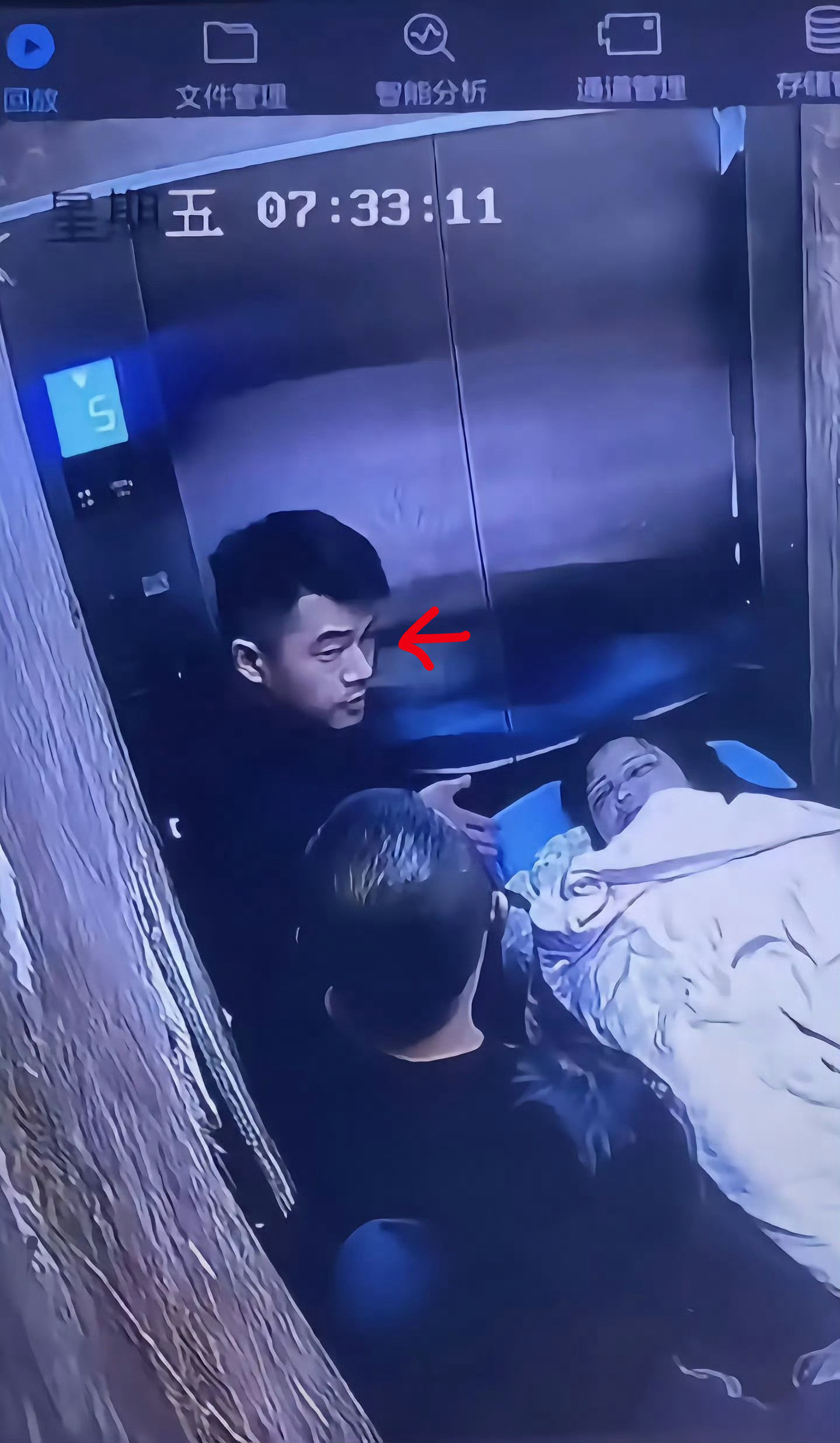 男性低级面相特征（三）孟村金昊杀妻就是故意杀害前两天讲男性山根严重折断，属于低