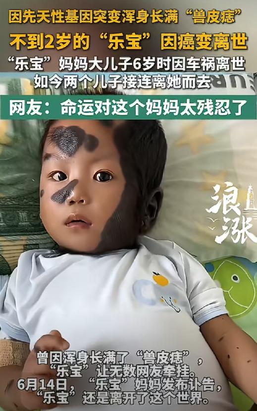 那个全身90%被“兽皮痣”覆盖的男孩乐宝，还是走了。母亲发讣告时写道：一生很短，