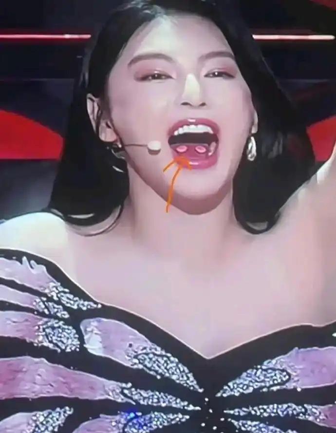 天呐，张雨绮舌头上是什么东西啊？有人知道吗？乍一看以为长了两个大泡，真让人担