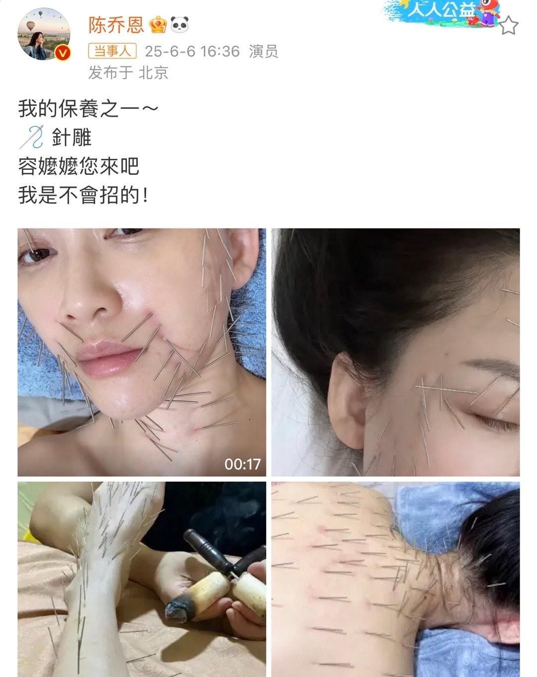 容嬷嬷当年真的扎错了人紫薇和小燕子多无辜，要扎就扎东方不败呀，是不是怕她的葵花