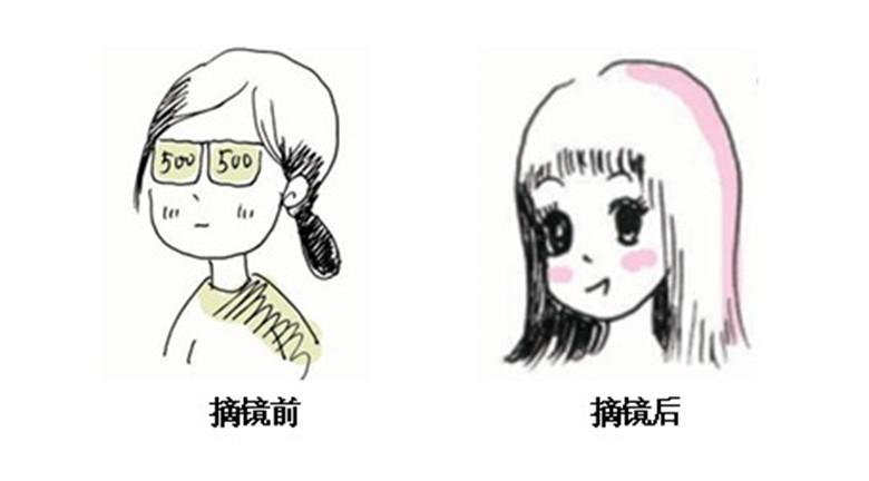 做近视手术是什么样的体验?
