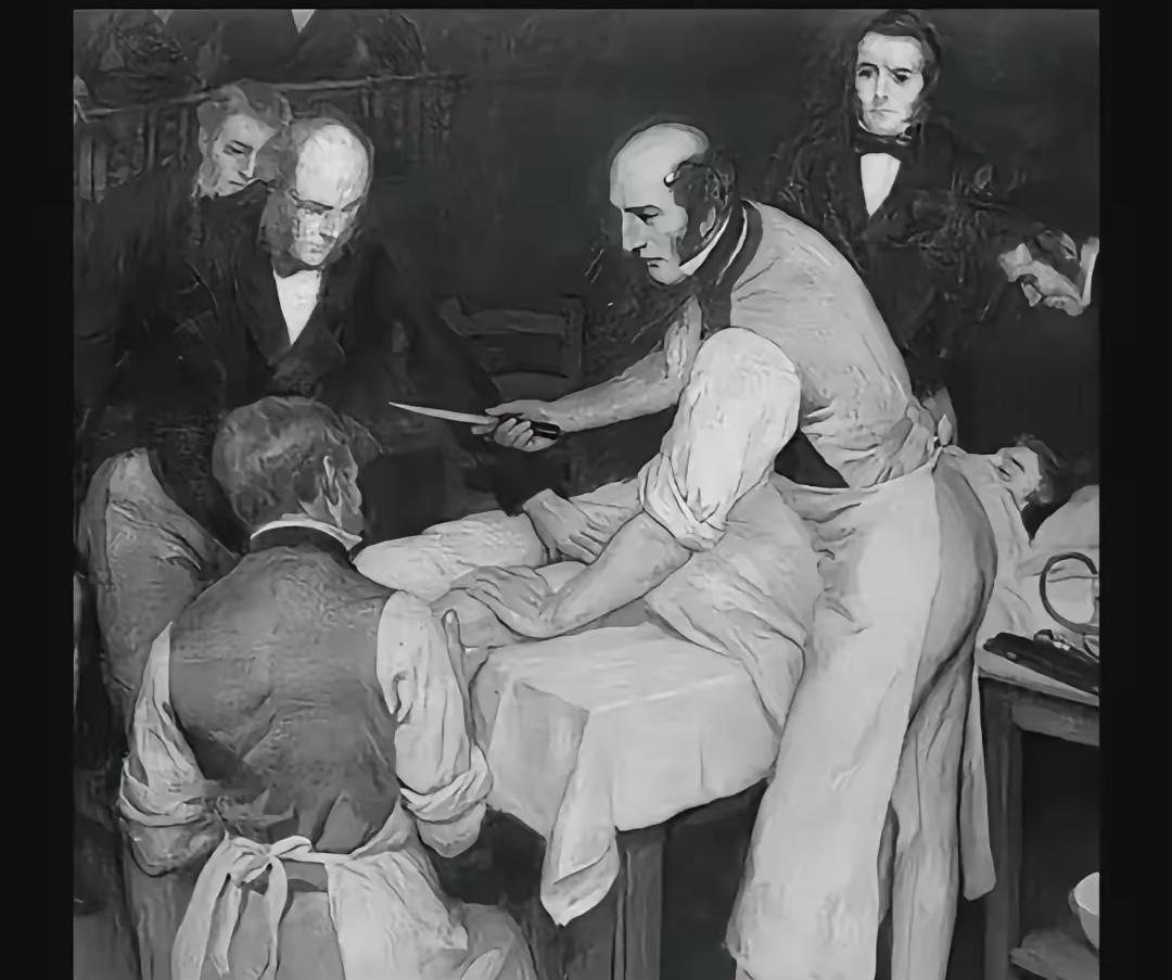 这是我听过的一件最离谱的事情：罗伯特．李斯顿，英国外科医生，在没有现代麻醉的年