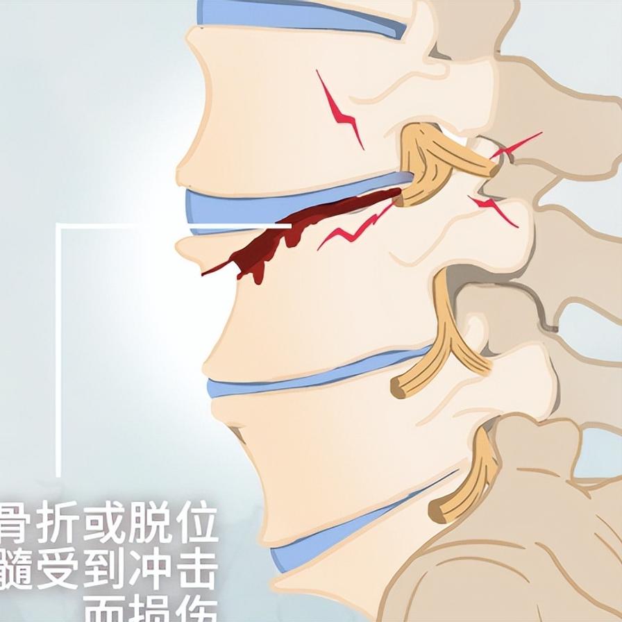 神经恢复有“暗号”！身体偷偷发出这7个信号，你收到了吗？很多神经损伤的朋友每